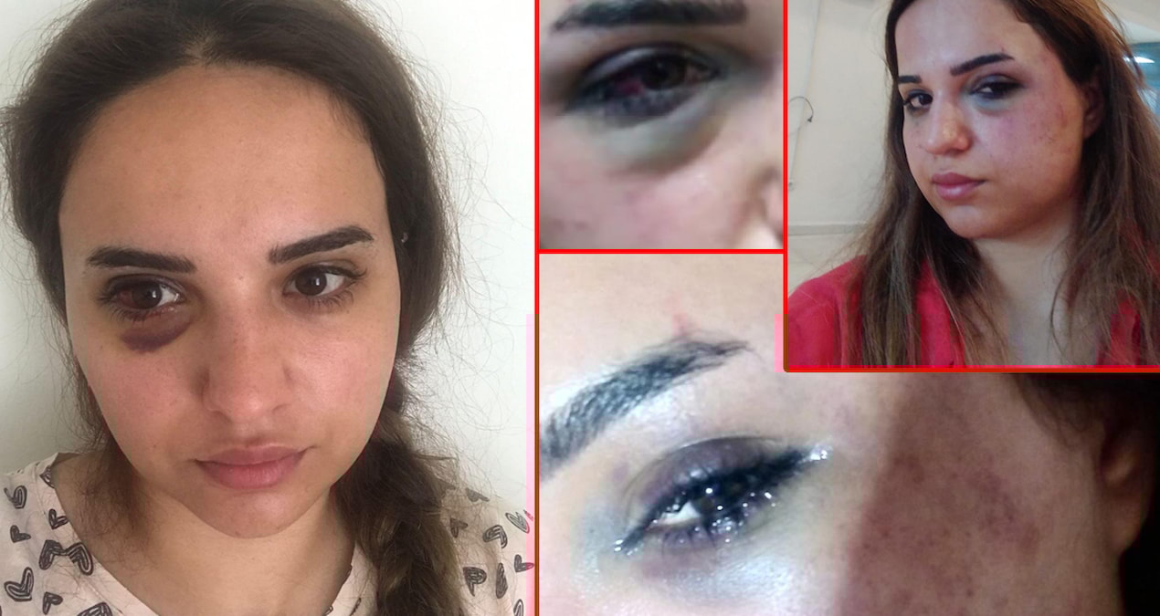 Bir yıldır boşanmak istediği eşi Leyla’yı bu hale getirdi