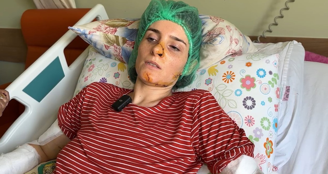 Evlilik yıl dönümünde dehşeti yaşamıştı! Sinem’den sevindiren haber