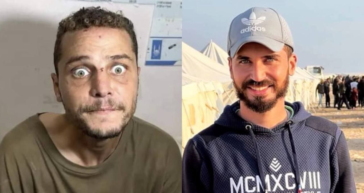 İşkence kabusu: Genç adamın görüntüsü gündem oldu