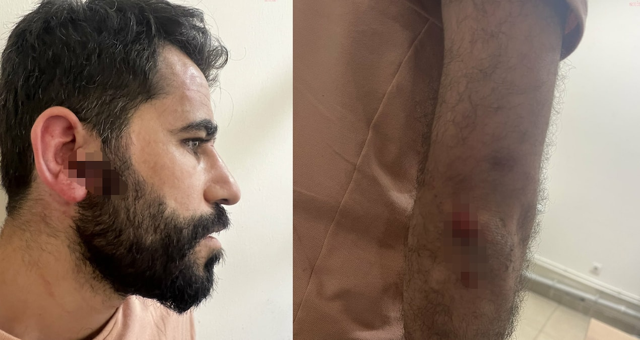 İstanbul Barosu’dan polis şiddeti açıklaması