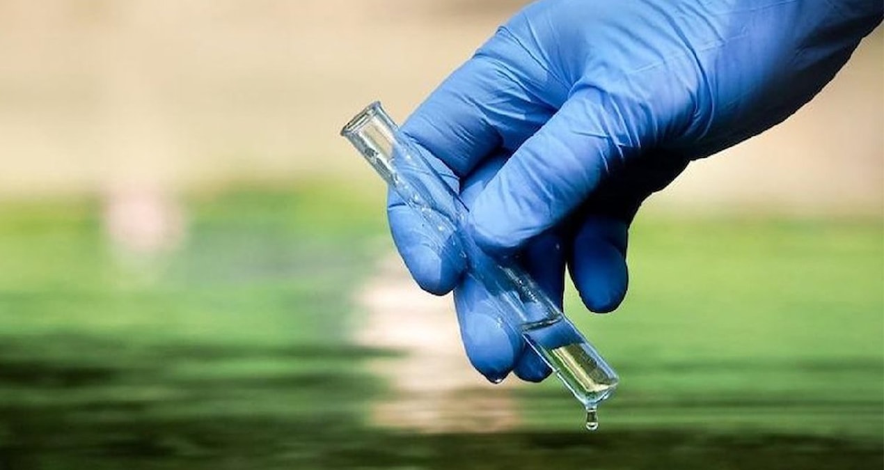 Nijerya’da kolera salgını: 35 ölü