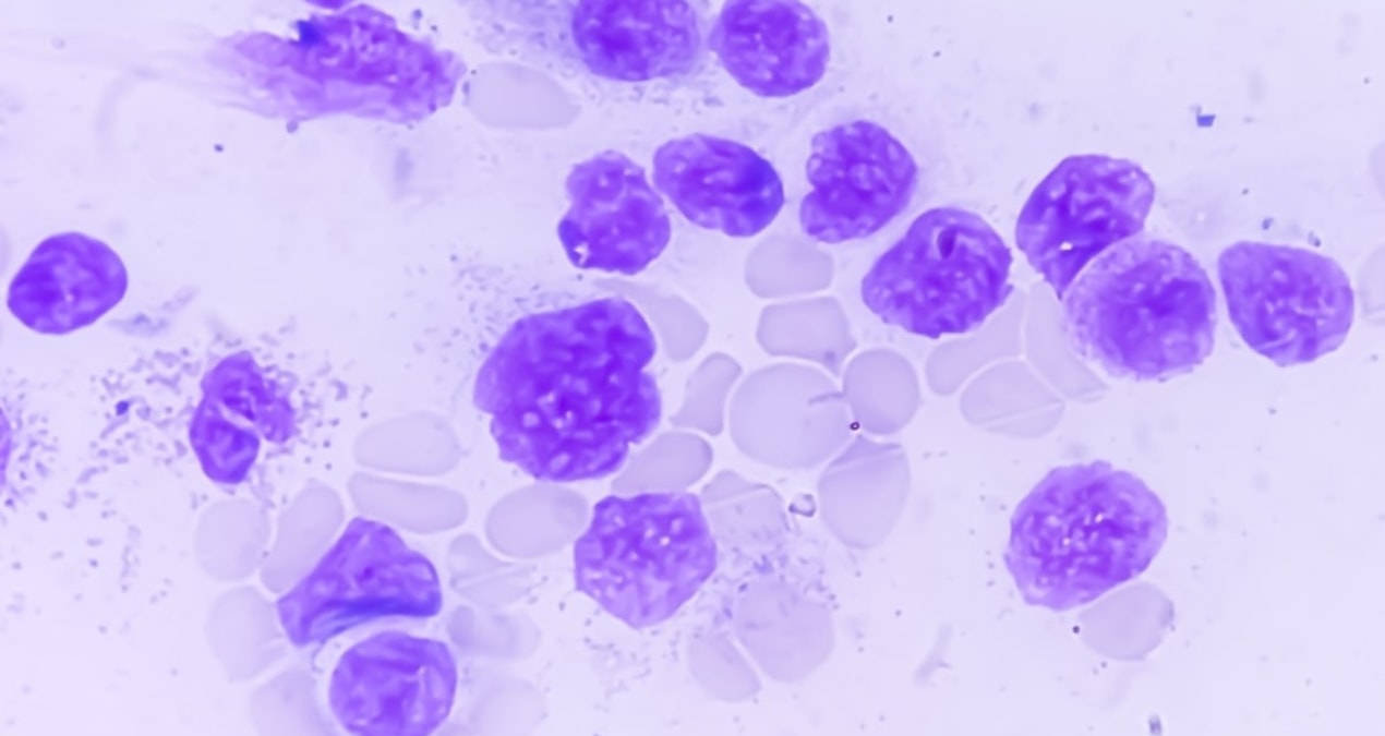 Oxford Üniversitesi’nden kanserle mücadelede floresan boya çözümü