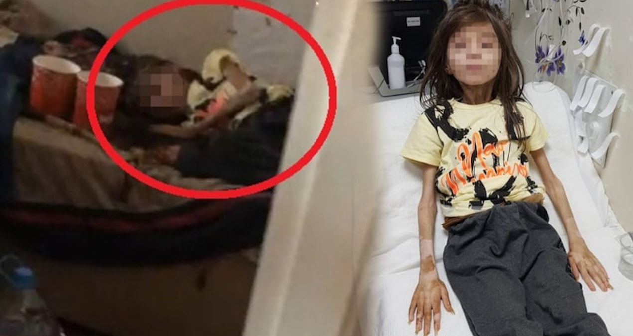 Yeğenini çöp evde açlığa hapsetmişti… Teyzenin cezası belli oldu