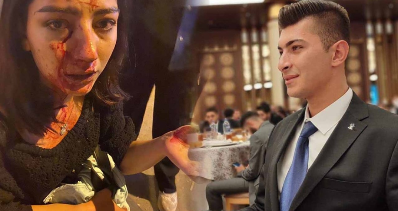 AKP Gençlik Kolları Başkanı konserde genç kızı hastanelik etti