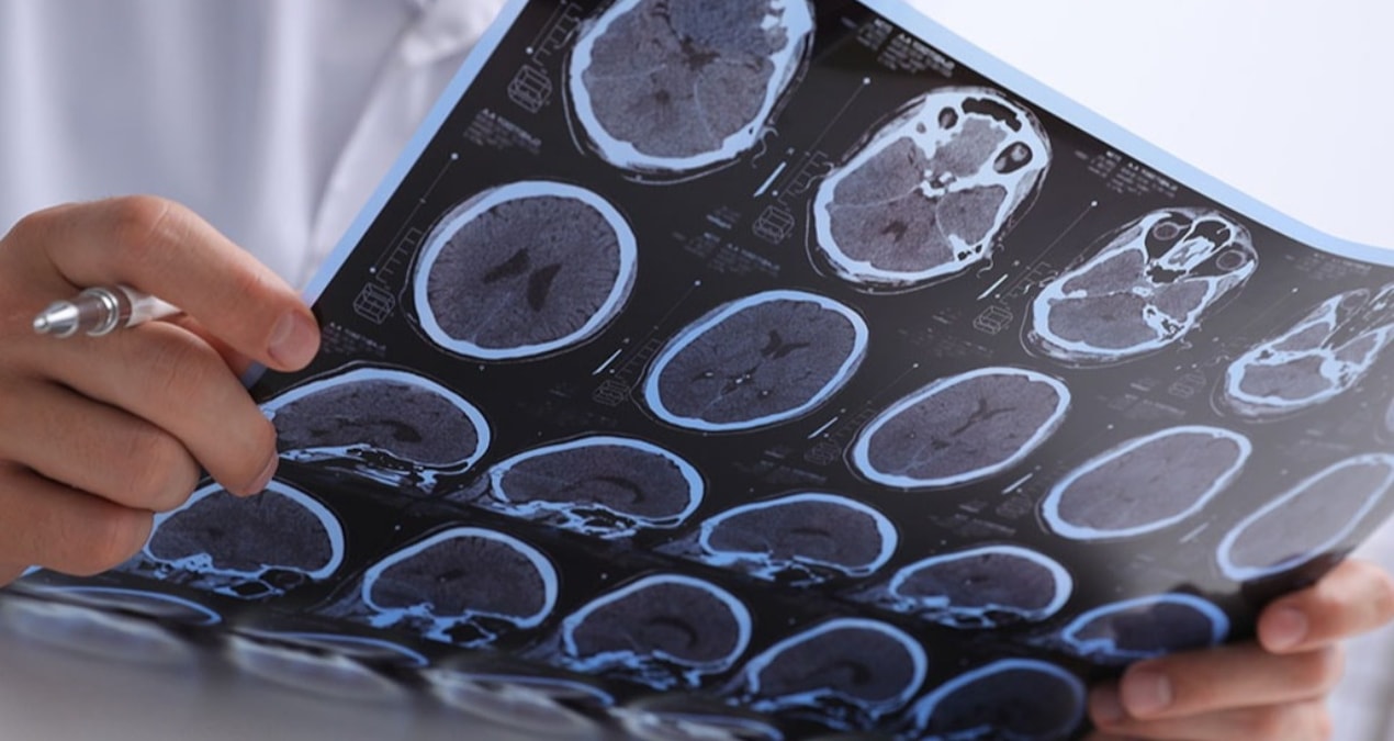 Araştırma sonuçlandı: Beyin kitap gibiymiş