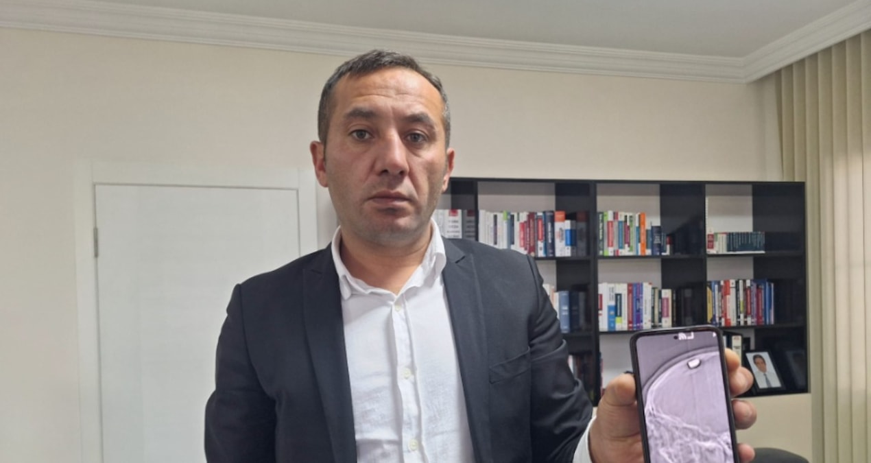 Başından vurulmuştu… Kurye ölü taklidi yaparak kurtulmuş