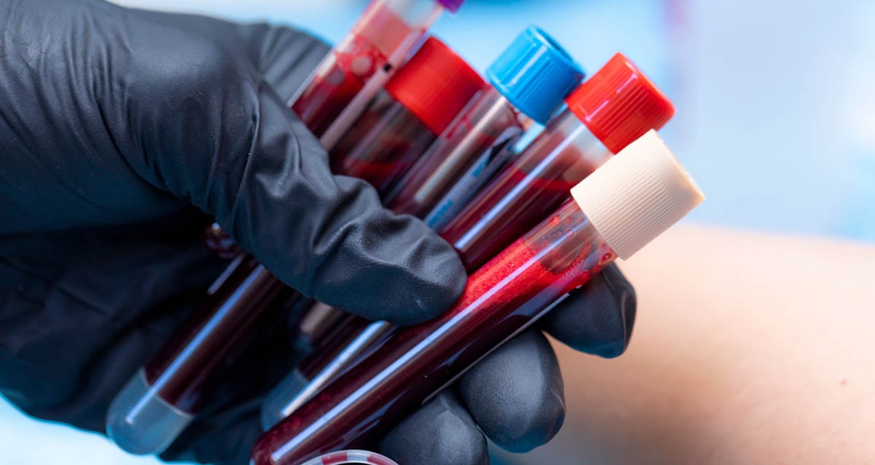 Bu kan grubuna sahip olanlar 60 yaşından önce felç geçirme riski taşıyor!