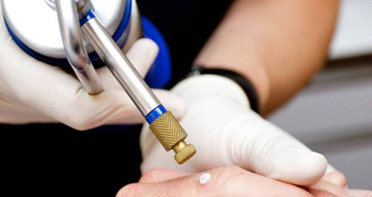 Kalp ritim bozukluklarına ‘dondurma yöntemi’ ile çare bulunuyor