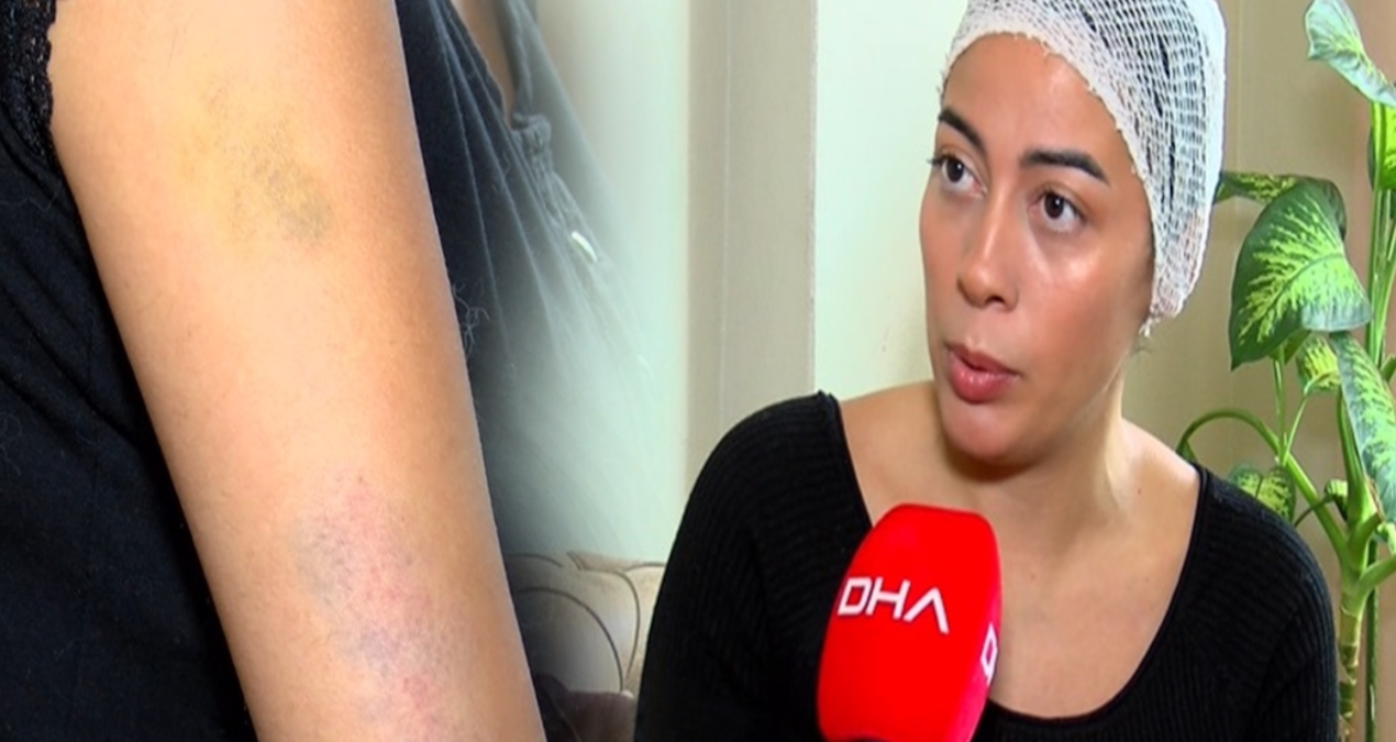 Miras tartışmasında dehşet: Demir çubukla dövdü