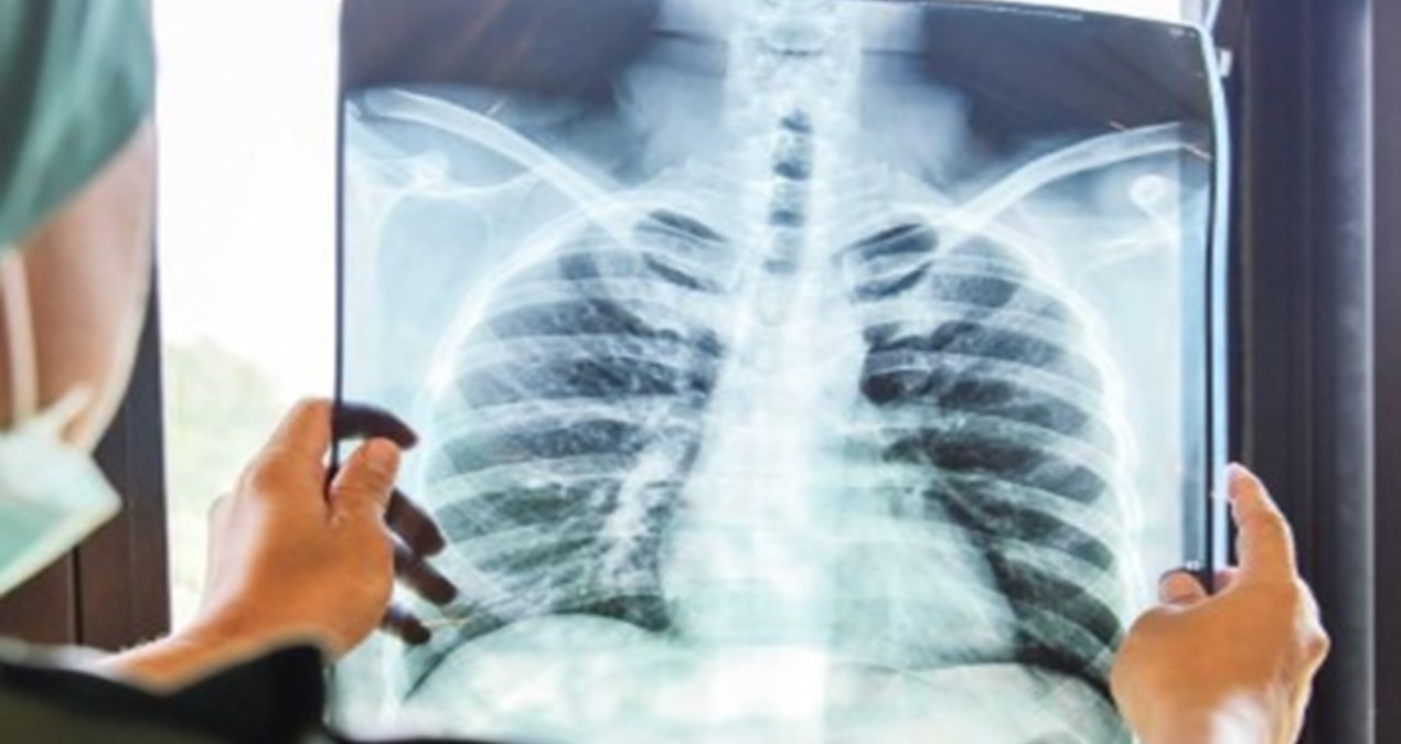 Pandemi sonrası artış var: En fazla çocuklarda görülüyor